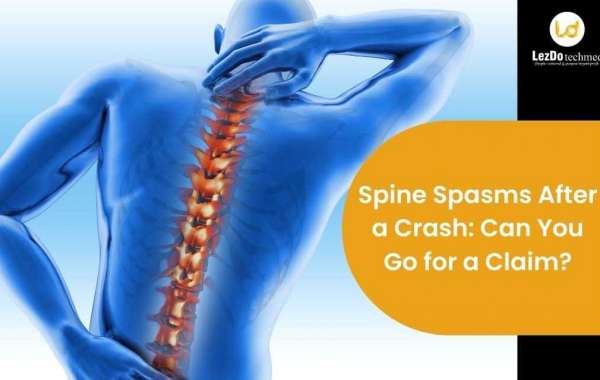 Spine spasm after a crash: Can you go for a claim?
