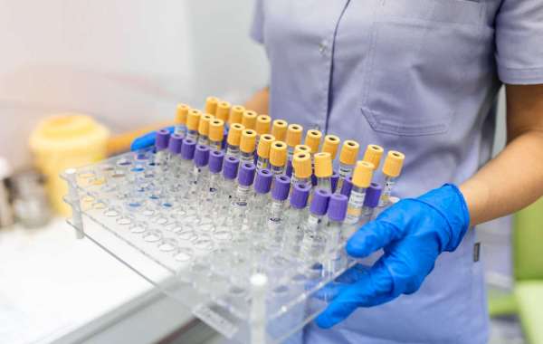 Nucleic Acid Sample Preparation Market Exhibits higher growth prospects during 2022-2023 | BIS Research