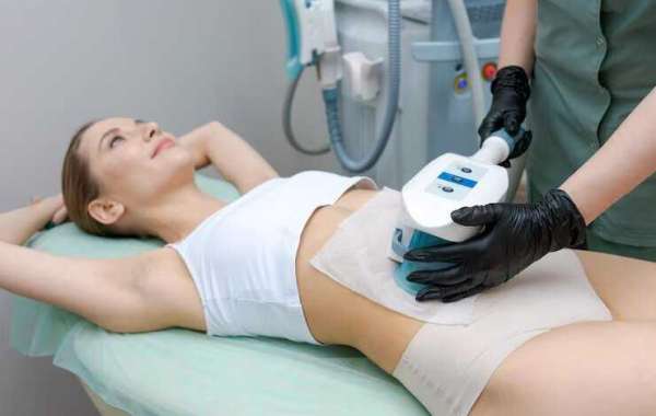 Top CoolSculpting in Los Angeles for Body Contouring