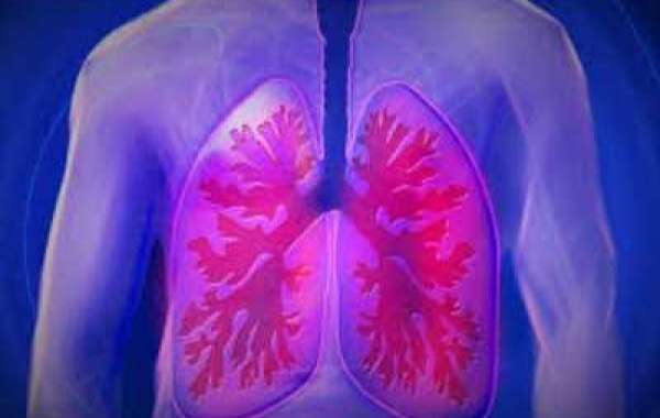 Lung in Vitro Model Market Soars $976.1 Million by 2030
