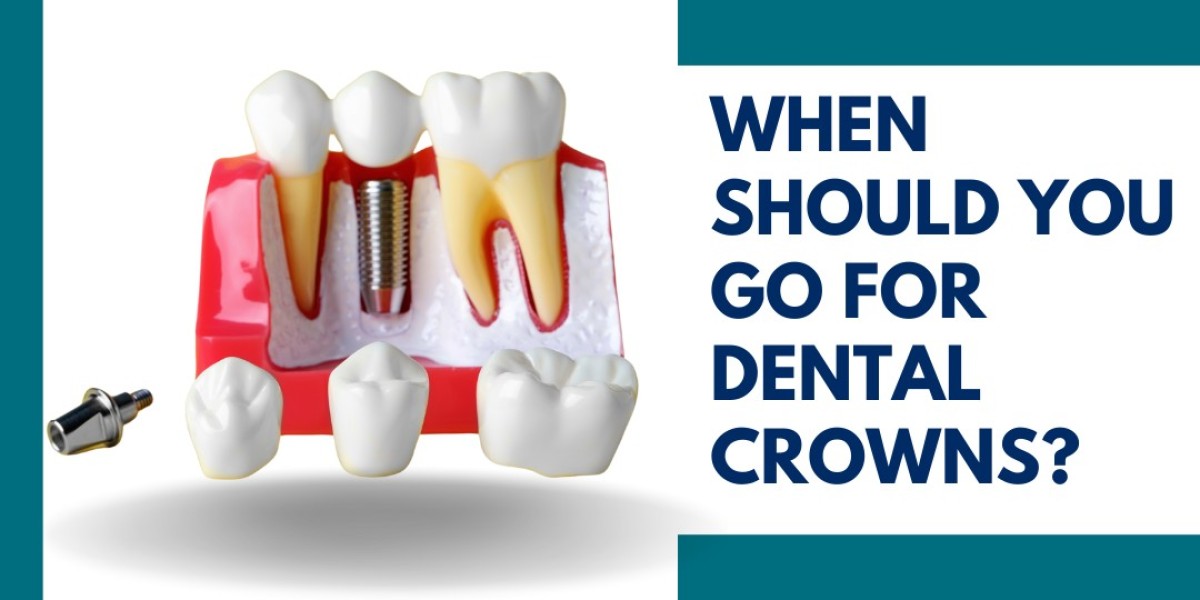 When Is It Time to Get Dental Crowns?