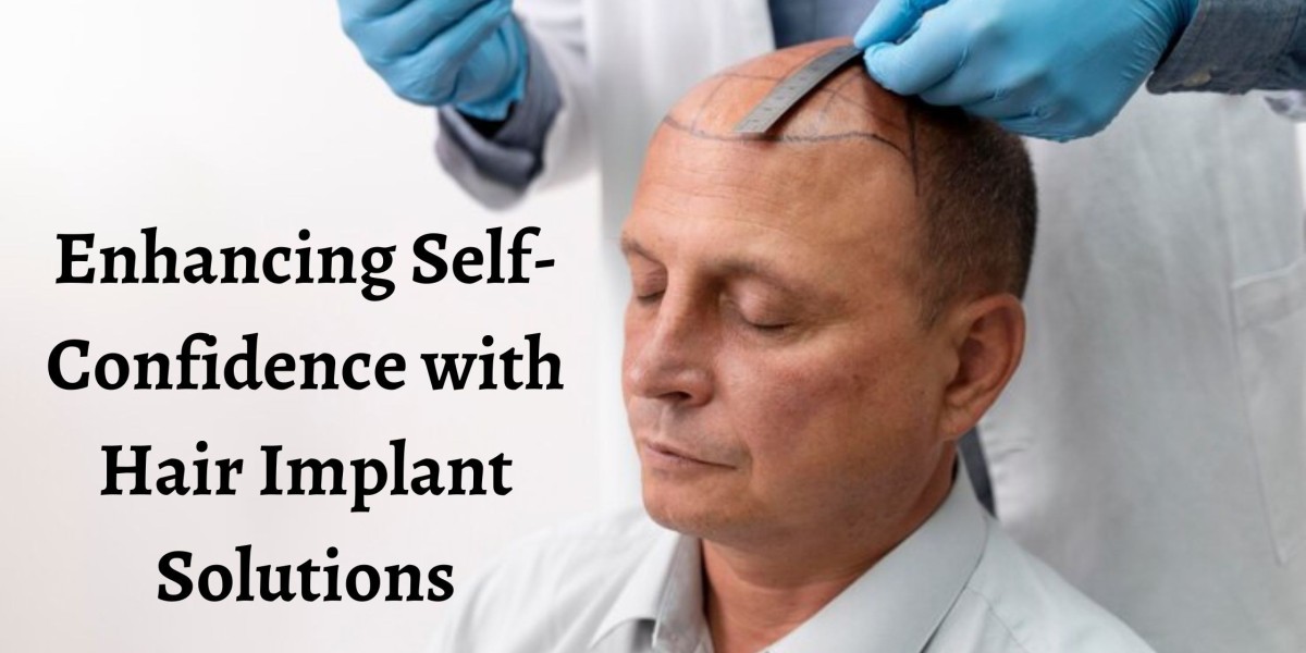 Enhancing Self-Confidence with Hair Implant Solutions