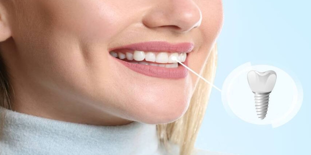 Invisalign and Gum Treatment: The Ultimate Dental Care Combo in the UK
