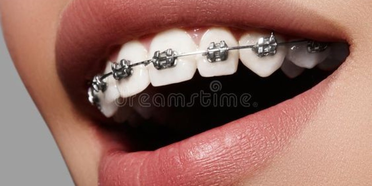 How to Choose the Right Orthodontist in Halifax for Your Needs
