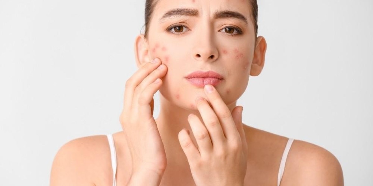 9 Best Products for Treating Bacterial Skin Conditions