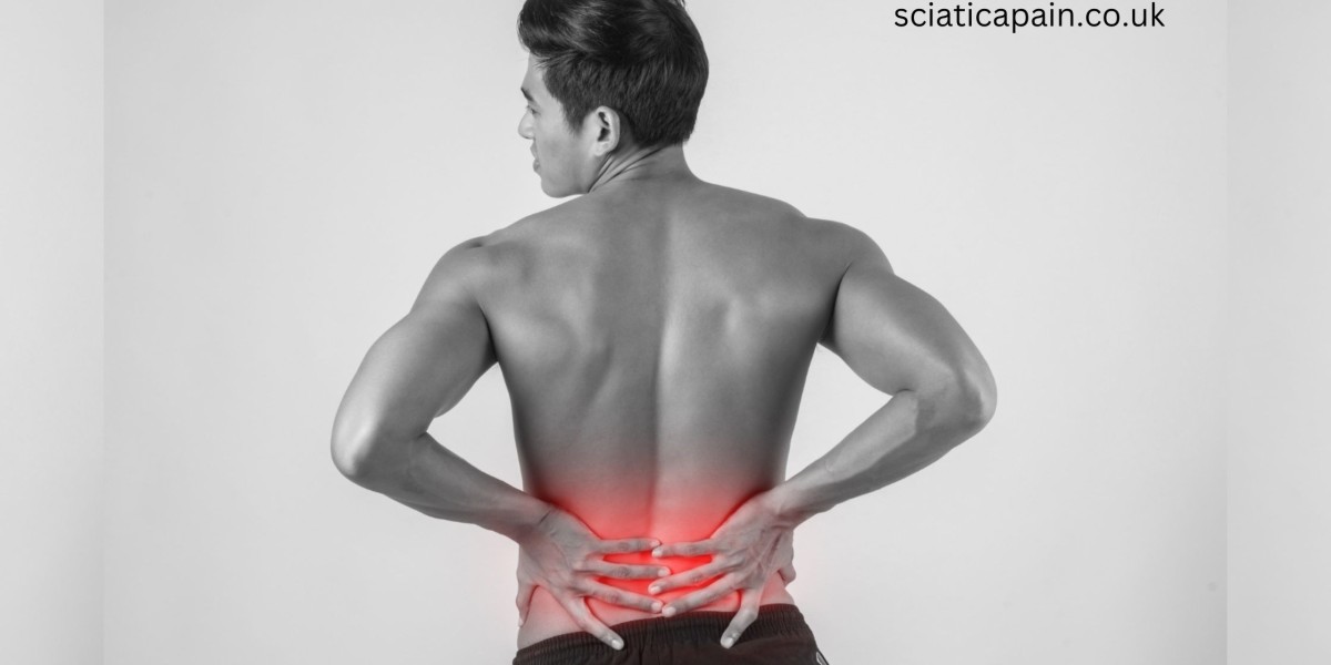 The Role of Pain Relief Creams in Sciatica Care and Wellness