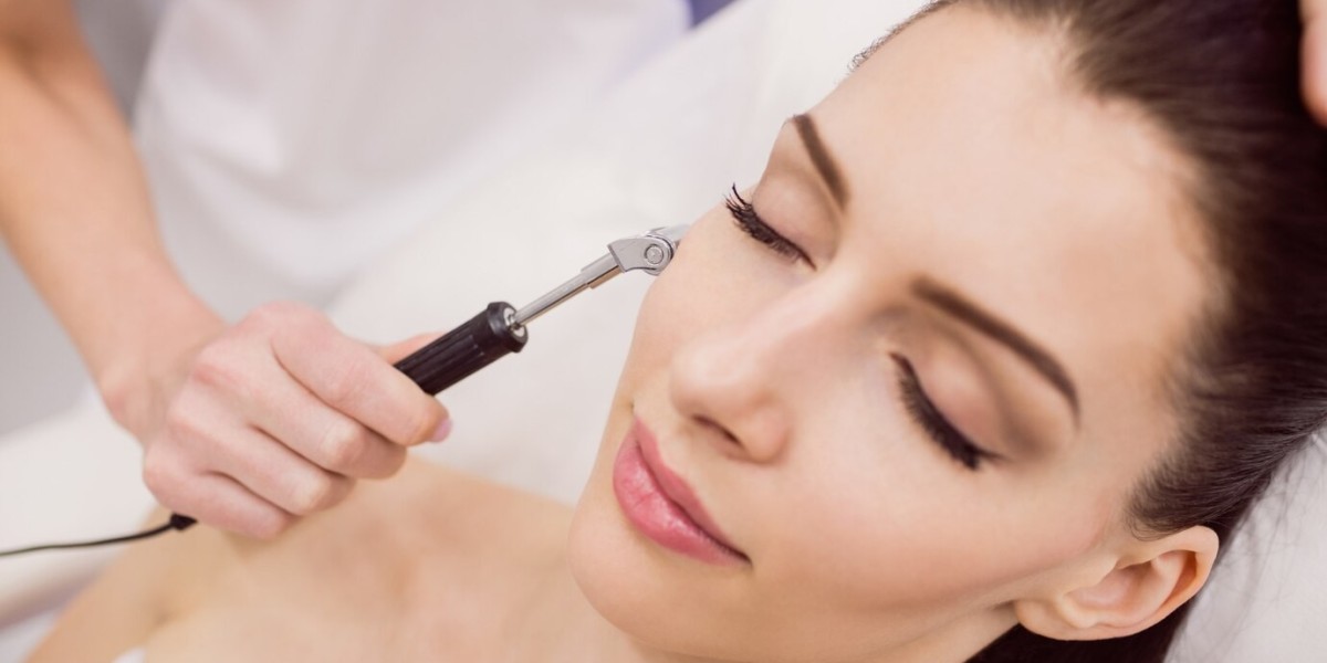 Everything You Need to Know About Dermaplaning in Tucson