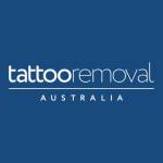 Tattoo removal Australia Profile Picture