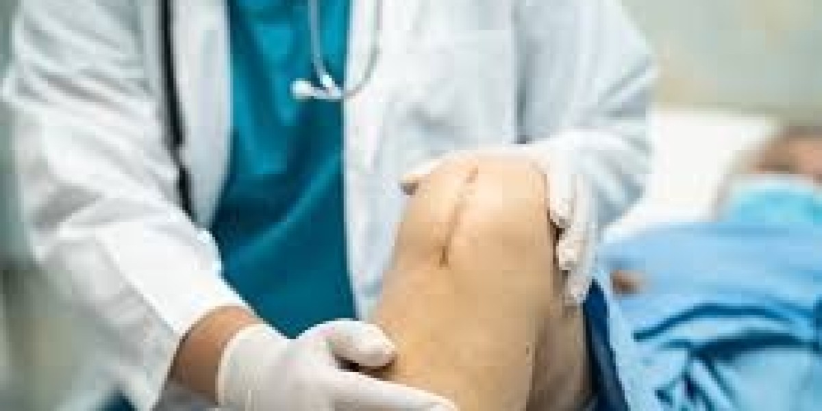 Knee Surgery in Singapore: A Comprehensive Guide