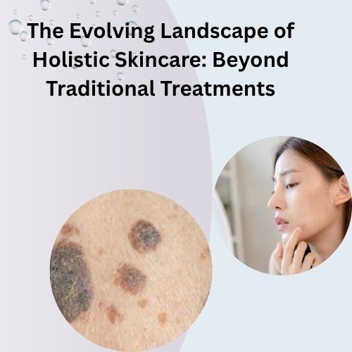 The Evolving Landscape of Holistic Skincare: Beyond Traditional Treatments - Herbal Care Products Blog